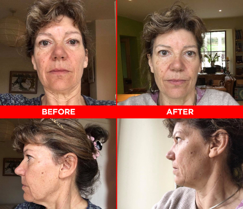 Face Yoga testimonial photo