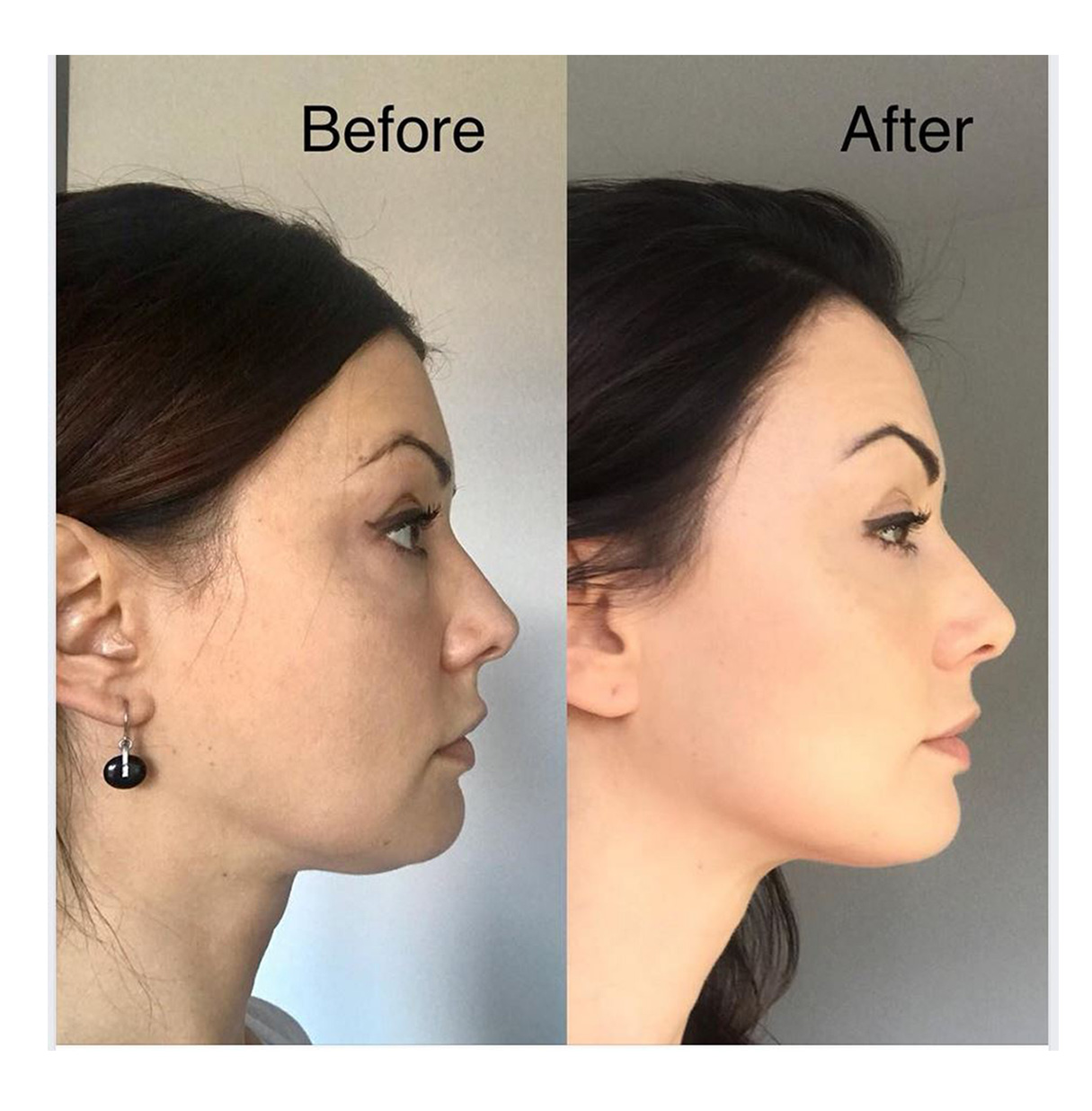 Face Yoga testimonial photo