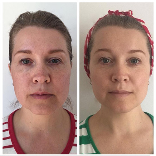 Face Yoga testimonial photo