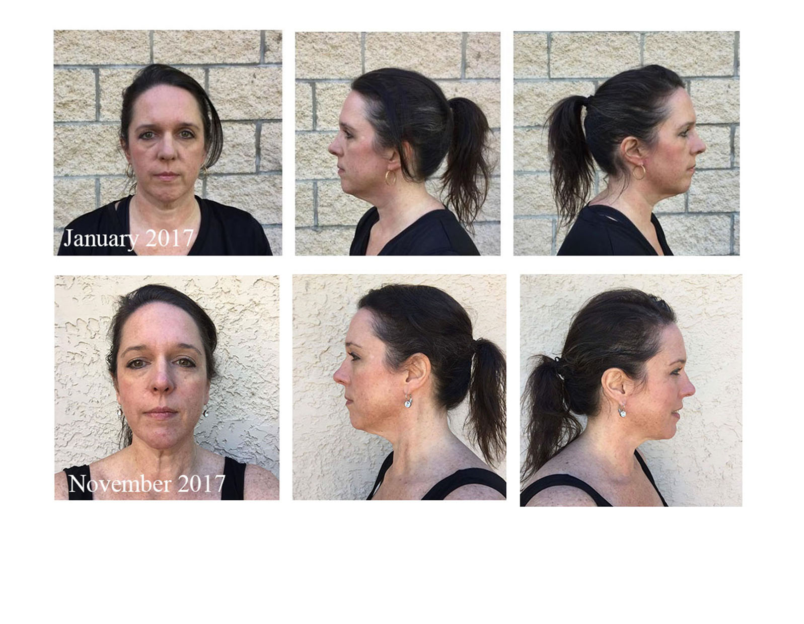 Face Yoga testimonial photo